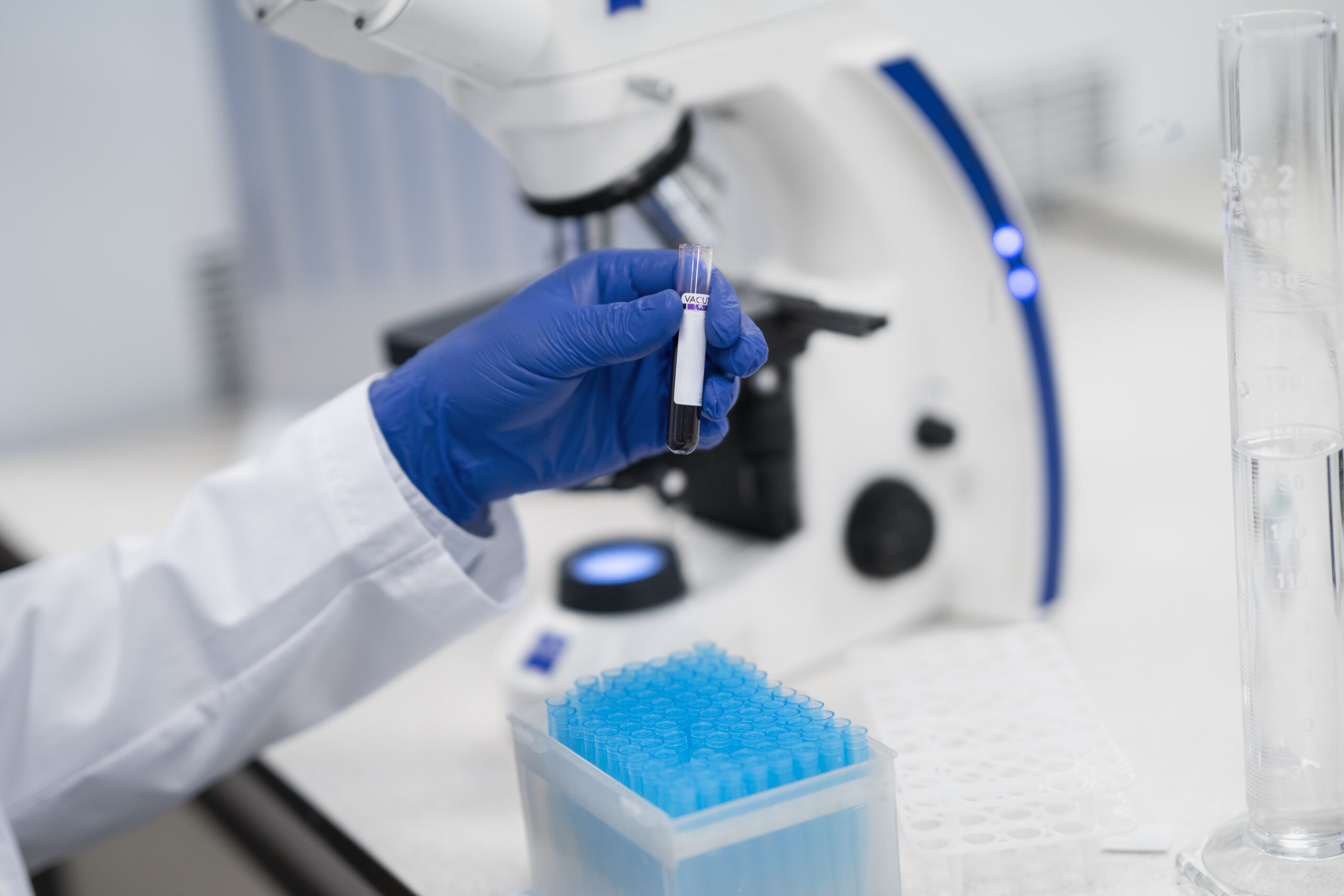 Punkt pobrań w Kolejarzu – co warto wiedzieć o naszych pakietach diagnostycznych?